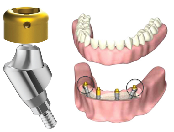 SIScator para Multi Unit